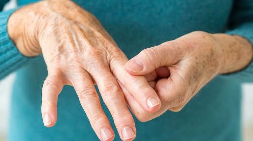 Memahami Penyakit Rheumatoid Arthritis dan Penanganannya